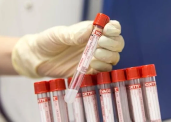 Məşhur müğənninin qanında narkotik  aşkarlandı