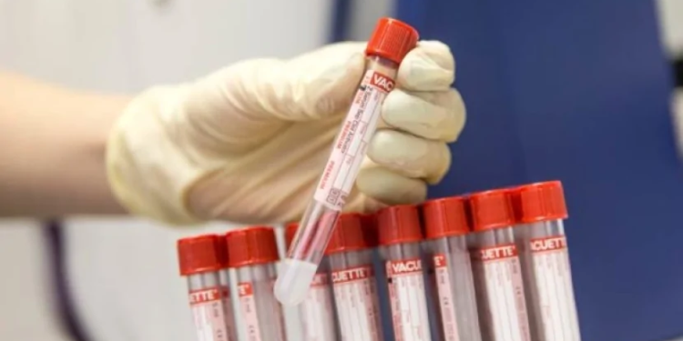 Məşhur müğənninin qanında narkotik  aşkarlandı 